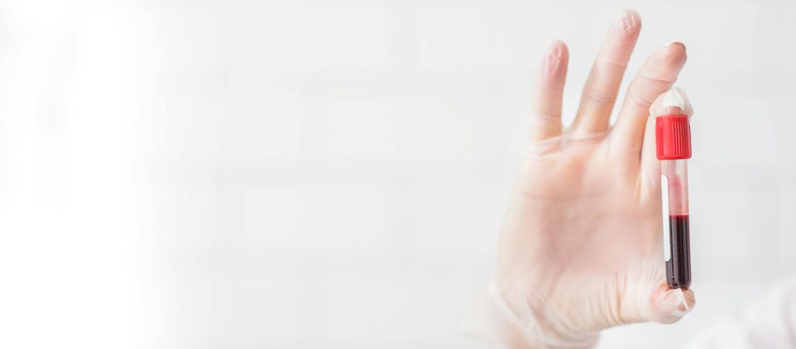 Adrénochrome : l’histoire d’un mythe glaçant Adrénochrome : l'histoire d'un mythe glaçant