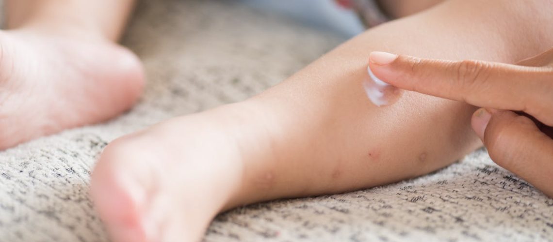 Piqûres de moustiques chez le bébé : comment gérer ?